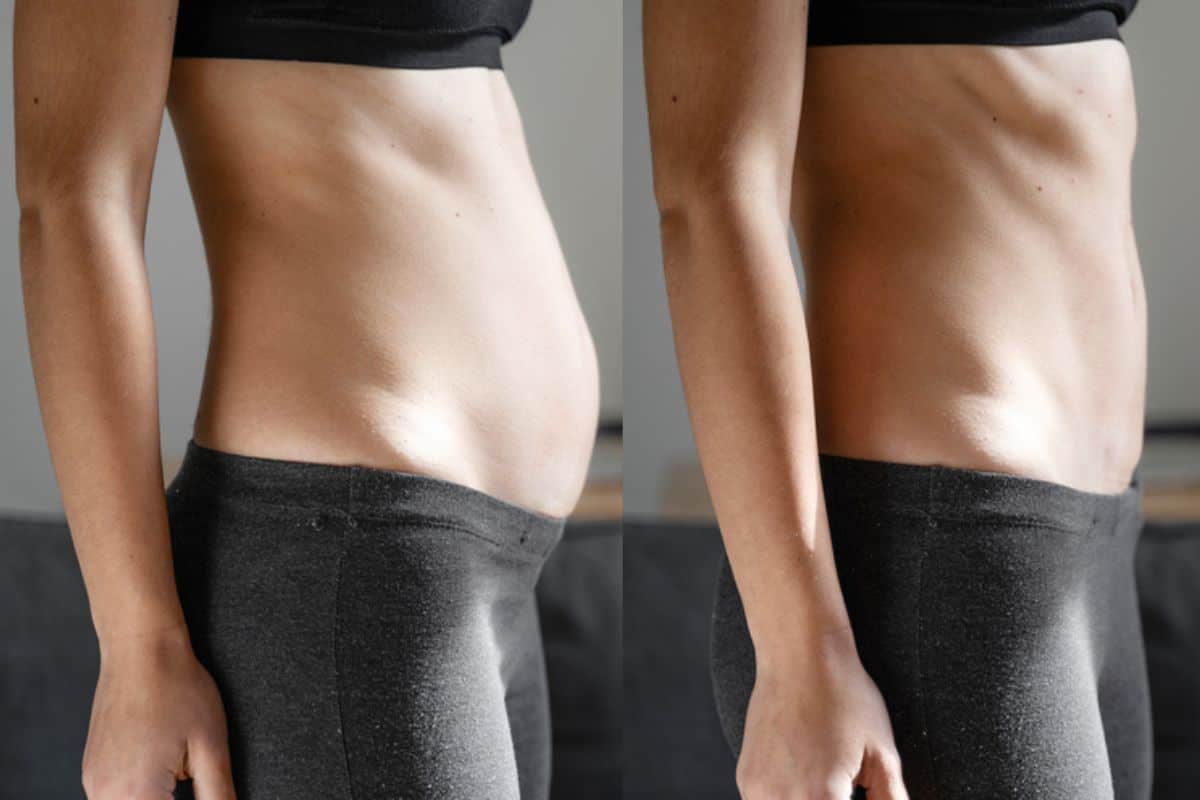 Post-Pregnancy: What Happens to Your Abdominal Muscles After Birth Hampstead