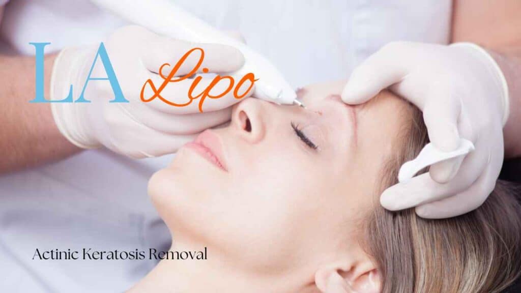 actinic keratosis removal Hampstead