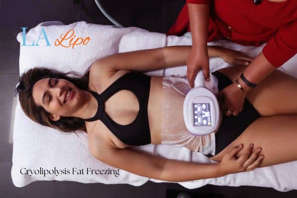 woman getting cryolipolysis Hampstead