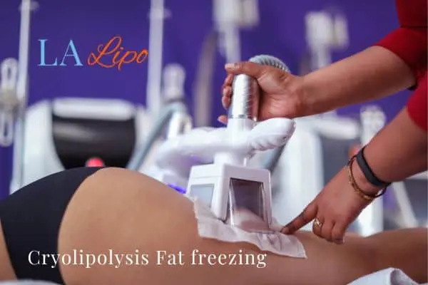 women getting fat freezing Hampstead