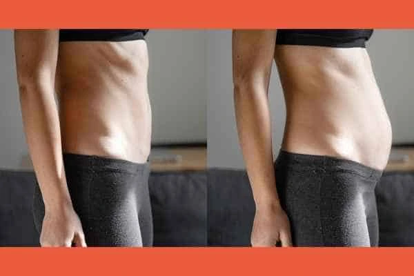 LA-EMS Body Sculpting results Hampstead