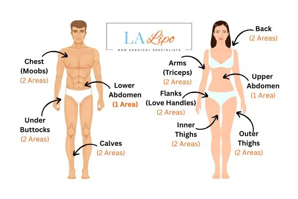 LA LIPO Cryolipolysis Areas Hampstead