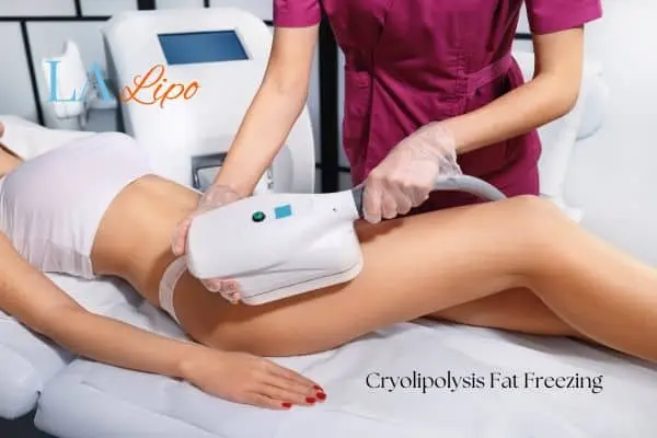 Woman receiving coolsculpting Hampstead treatment on her thighs