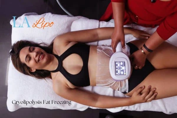 woman getting cryolipolysis Hampstead