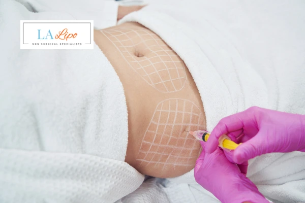 aqualyx fat dissolving injections Hampstead