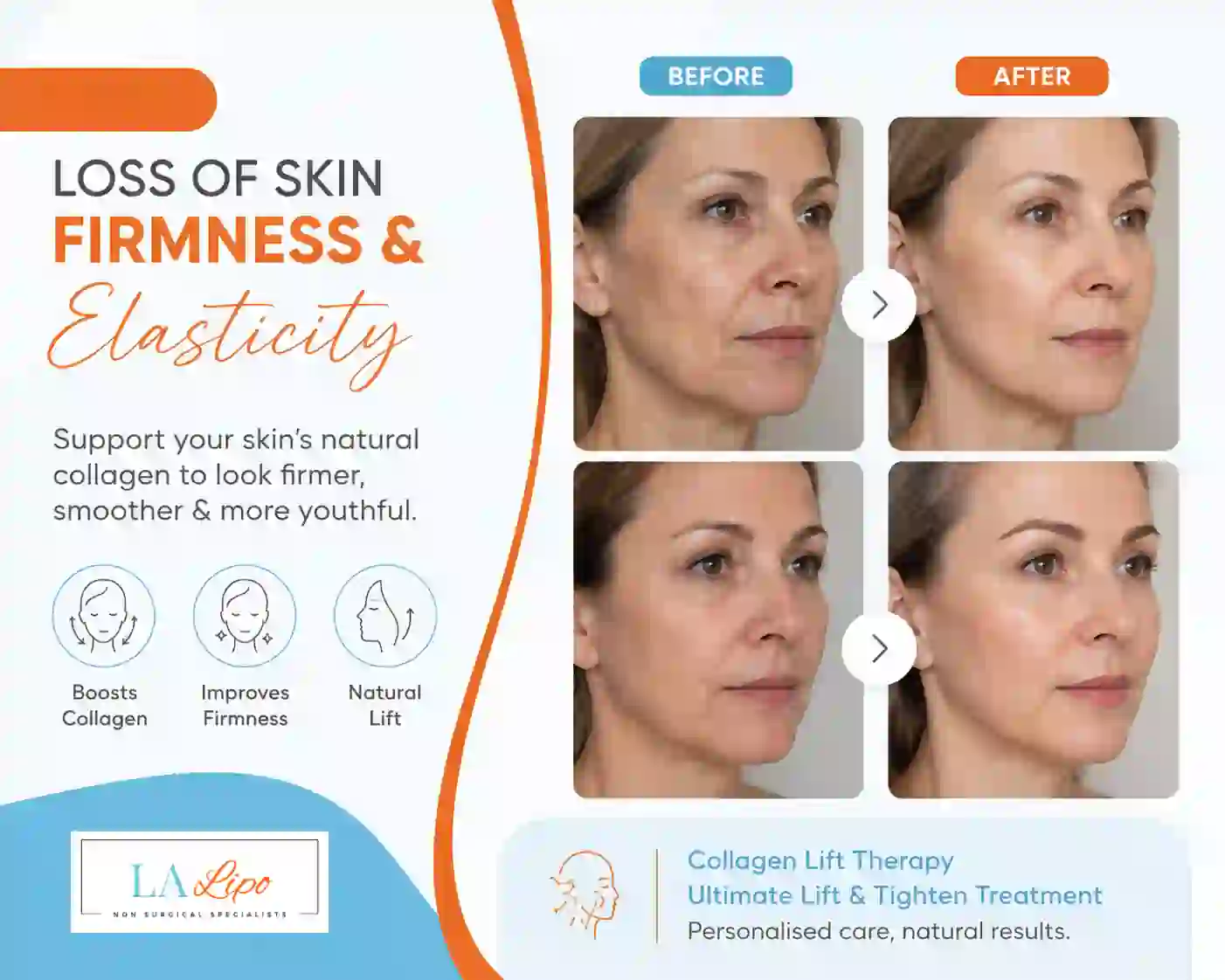 Sign #7: Loss of Skin Firmness and Elasticity Hampstead